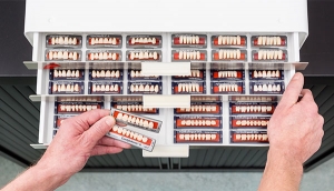 Kleurstalen voor uw prothese